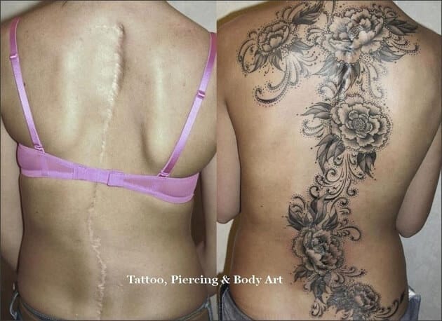 Tatouages cache cicatrices