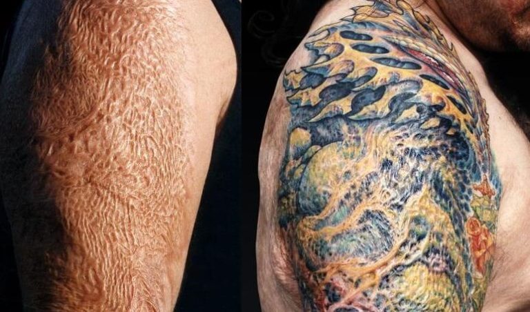 Quand de magnifiques tatouages masquent les cicatrices de la vie Tatouages cache cicatrices