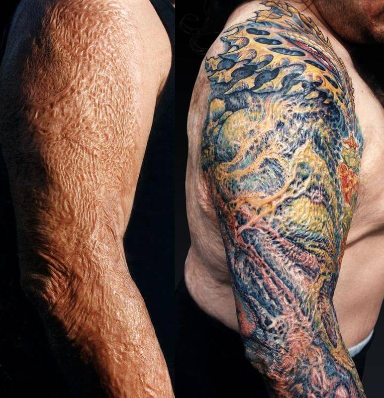 Tatouages cache cicatrices