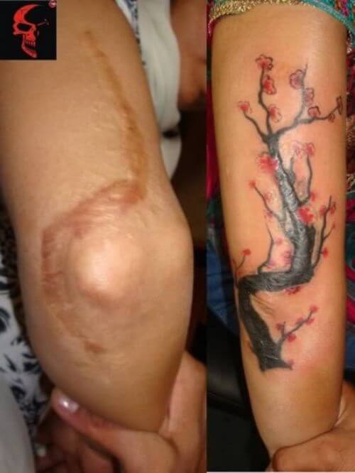 Tatouages cache cicatrices