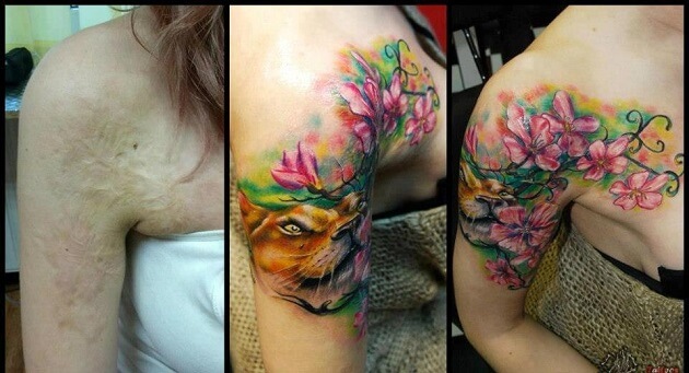 Tatouages cache cicatrices