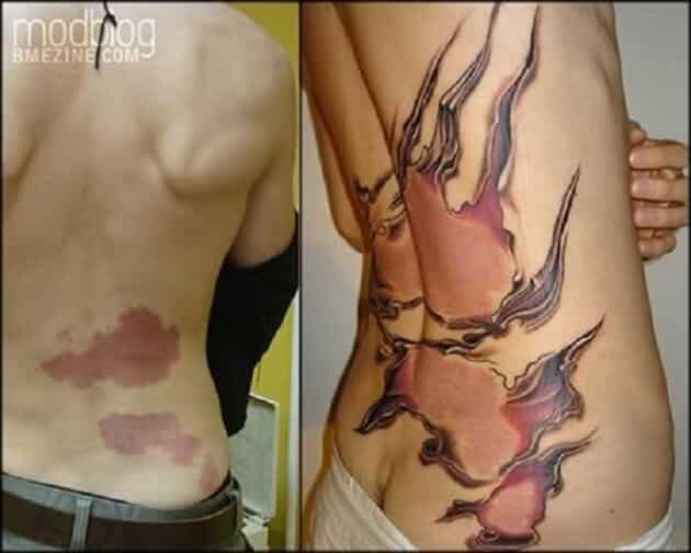 Tatouages cache cicatrices
