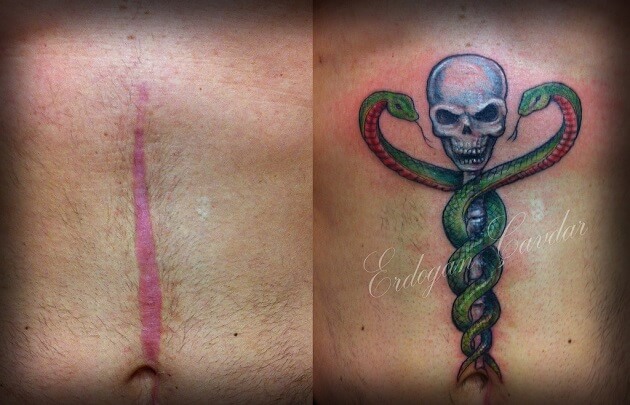 Tatouages cache cicatrices