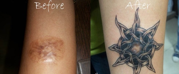 Tatouages cache cicatrices
