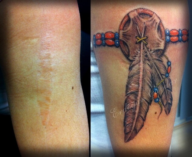 Tatouages cache cicatrices