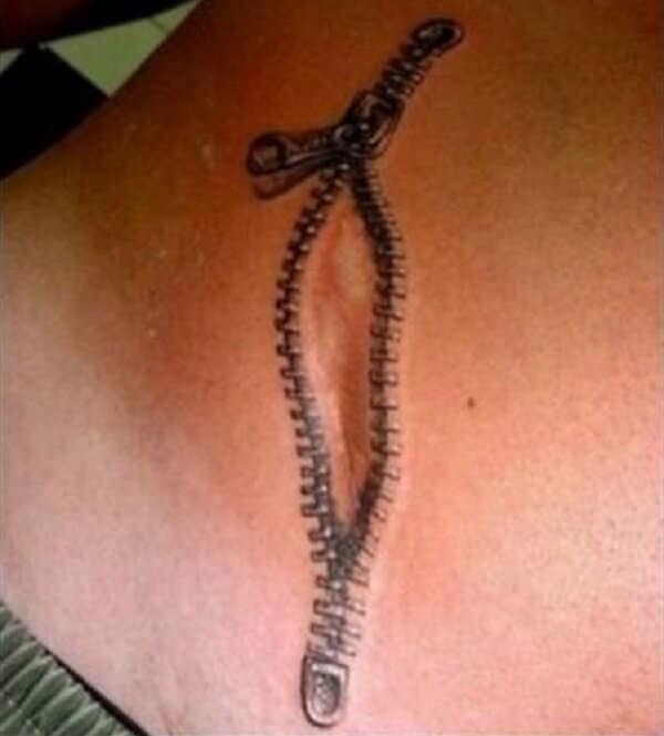 Tatouages cache cicatrices