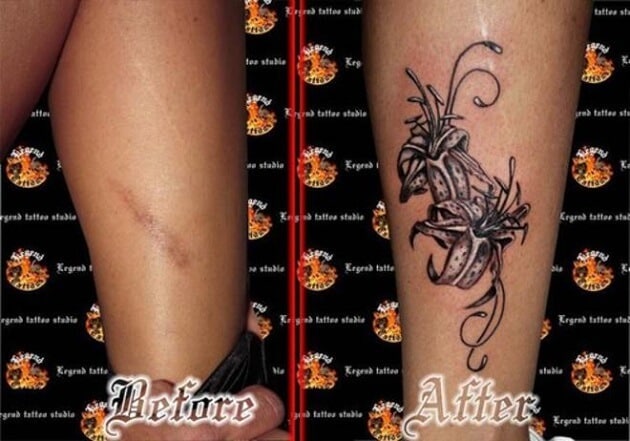 Tatouages cache cicatrices