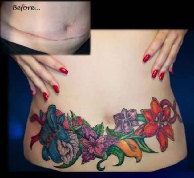 Tatouages cache cicatrices