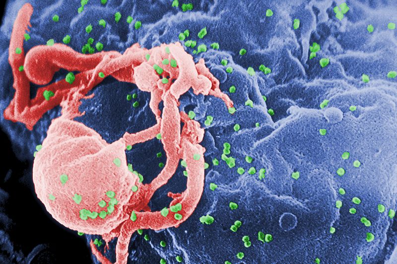 Théorie du complot, virus du SIDA